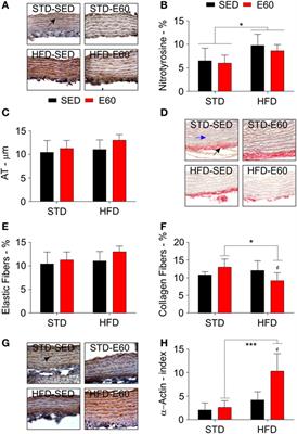 High-Fat and Fat-Enriched Diets Impair the Benefits of Moderate Physical Training in the Aorta and the Heart in Rats